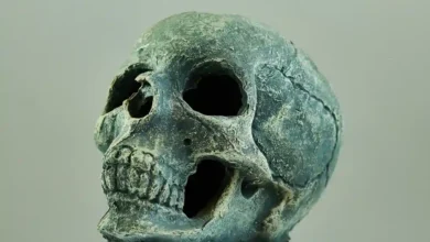 The Human Skull