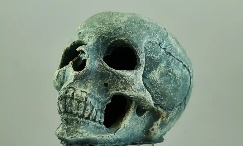 The Human Skull